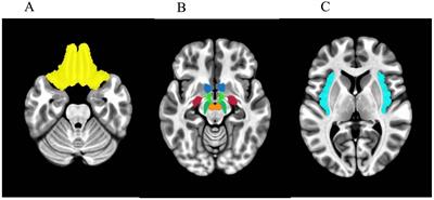 Genetic associations with neural reward responsivity to food cues in children